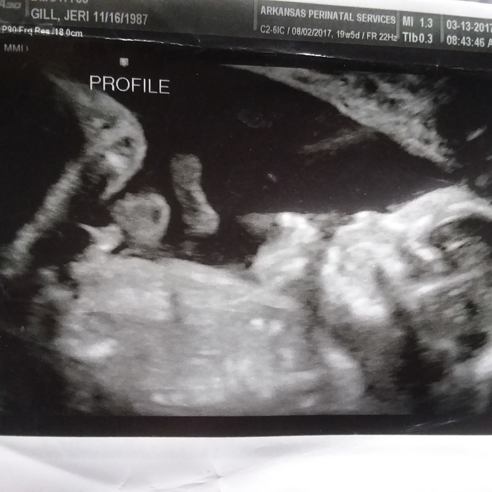 Plz Read Meet the Posher - Involuntarily Childless - Picture 2 of 8